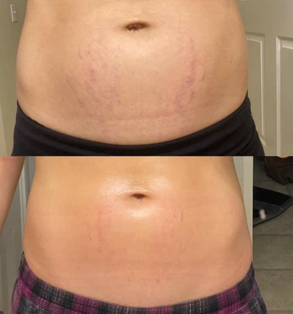 NEW 🌸 Rituel Huile Anti Vergetures Rose Musquée