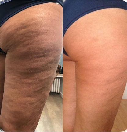 Huile Anti-Cellulite Naturelle - Fleur d'Oranger | Hydratante & Raffermissante